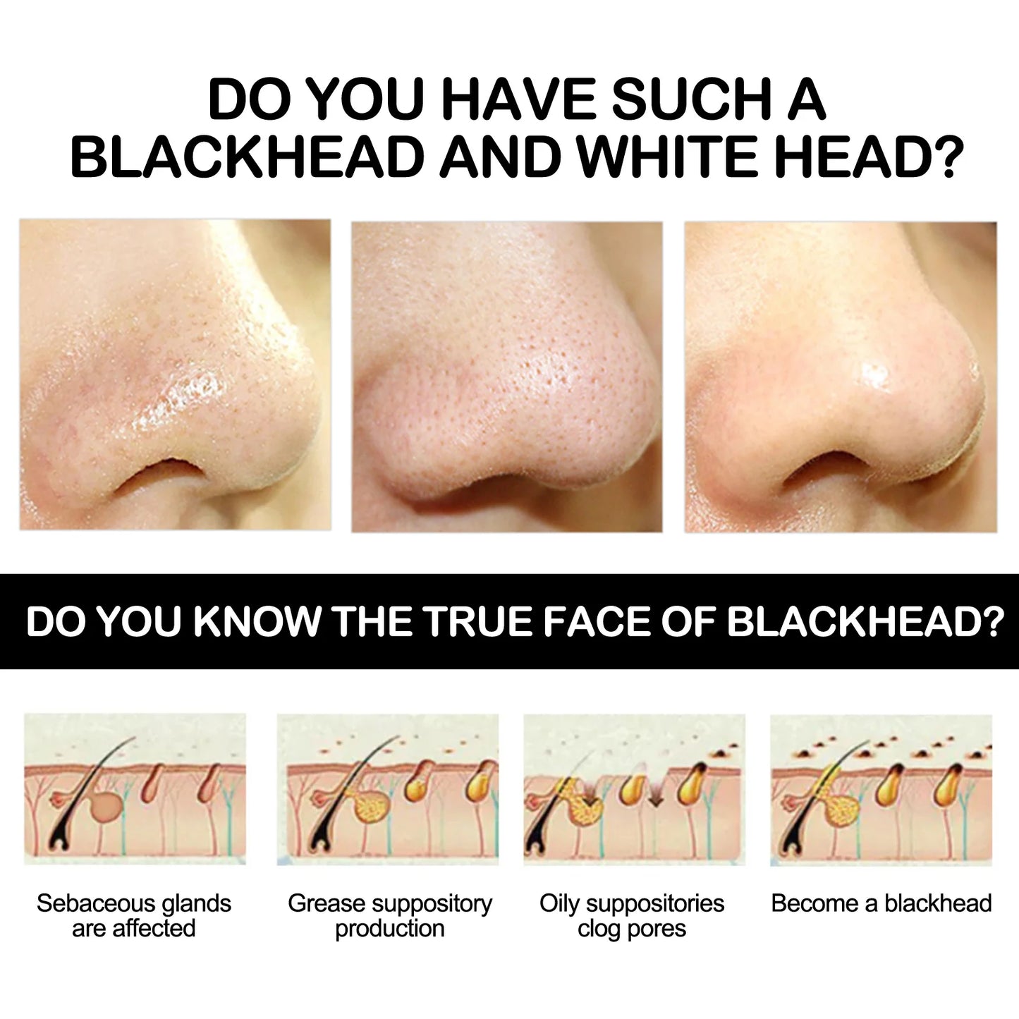 Masque anti-points noirs au charbon de bambou EELHOE - JOUVENCE COREENNE