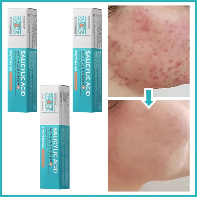 Crème Anti-Imperfections Acide Salicylique - JOUVENCE COREENNE