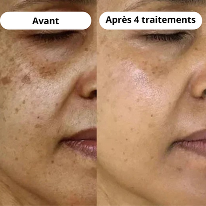 Huile Démaquillante Éclat Citrus - JOUVENCE COREENNE