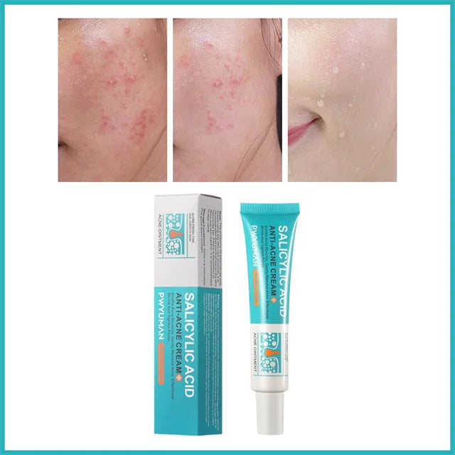 Crème Anti-Imperfections Acide Salicylique - JOUVENCE COREENNE