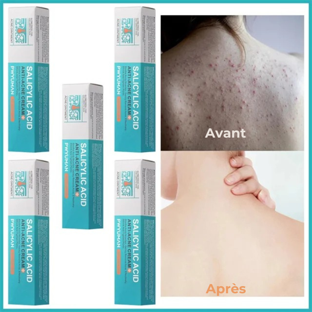 Crème Anti-Imperfections Acide Salicylique - JOUVENCE COREENNE