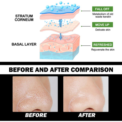 Masque anti-points noirs au charbon de bambou EELHOE - JOUVENCE COREENNE